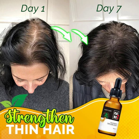 10X-Regro Strong Hair -seerumi