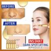 Instant Dark Spot Lifting Ampulli