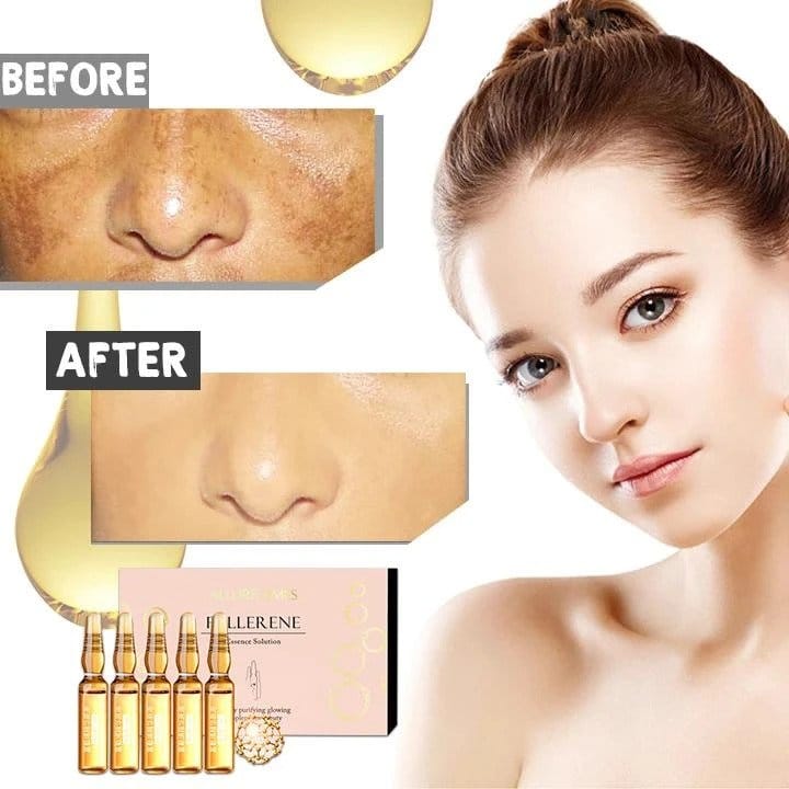 Whitening Spotless Ampoule Serum (7 kpl) - Image 2