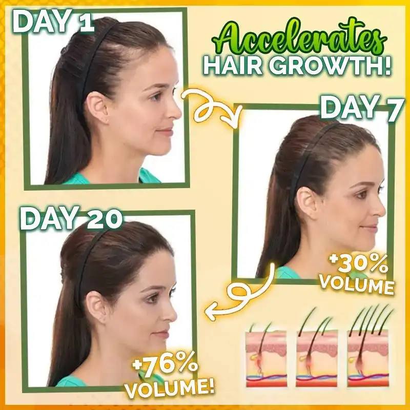 10X-Regro Strong Hair -seerumi - Image 2