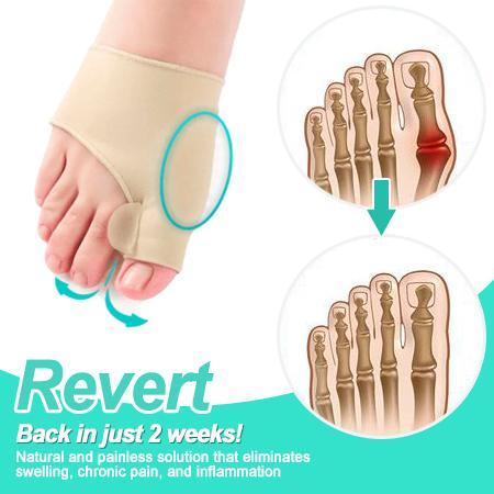 LUONNALLISET JALKAT Bunion Corrector - Image 2