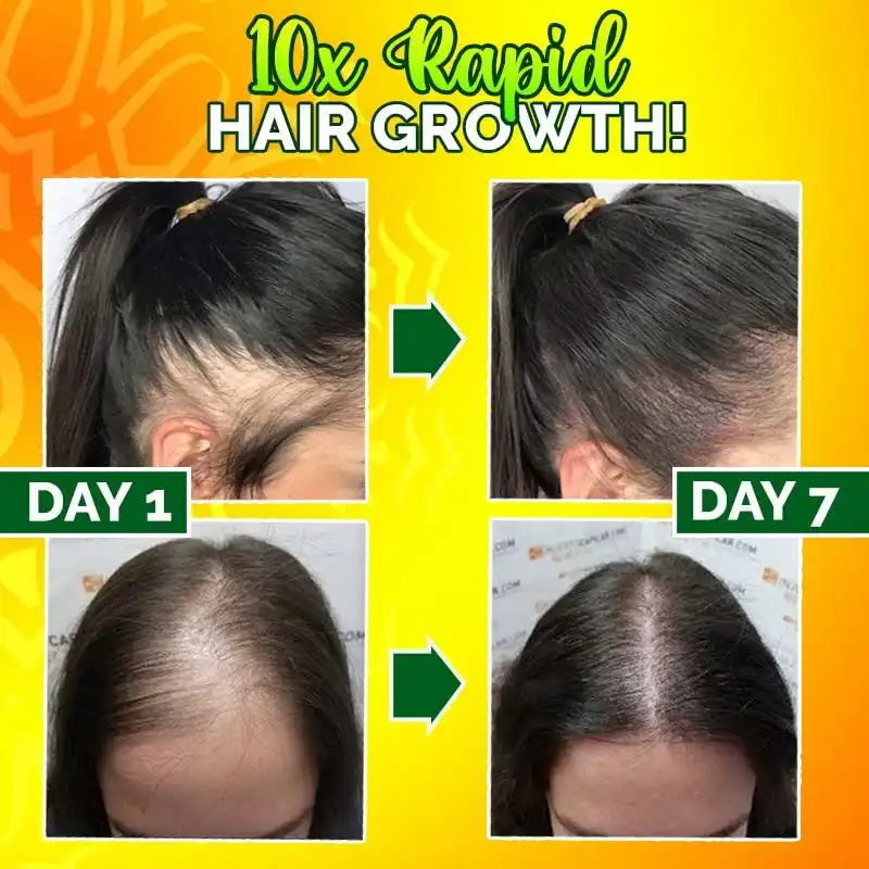 10X-Regro Strong Hair -seerumi - Image 3