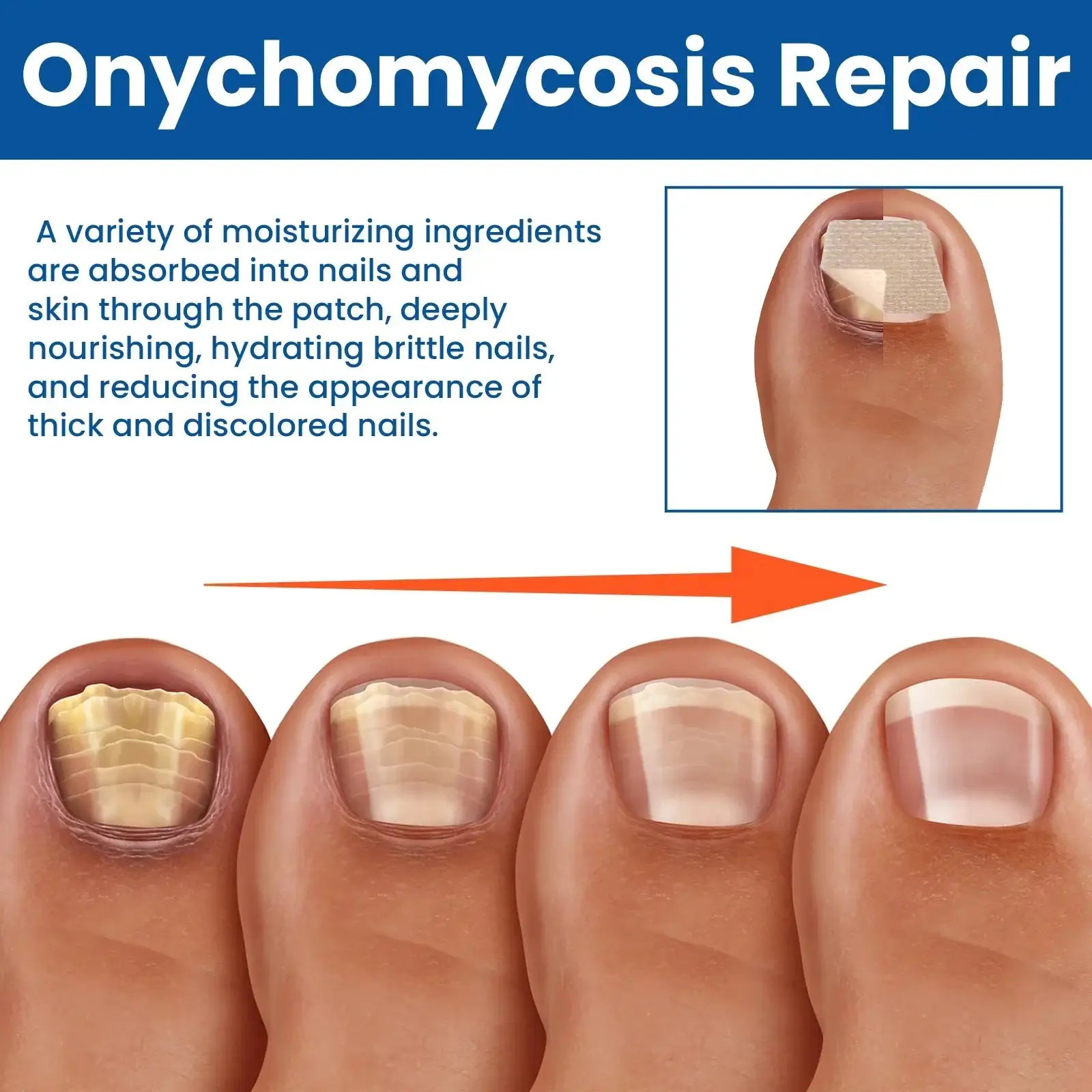 Sienen kynsien korjauslaastarit - Image 4