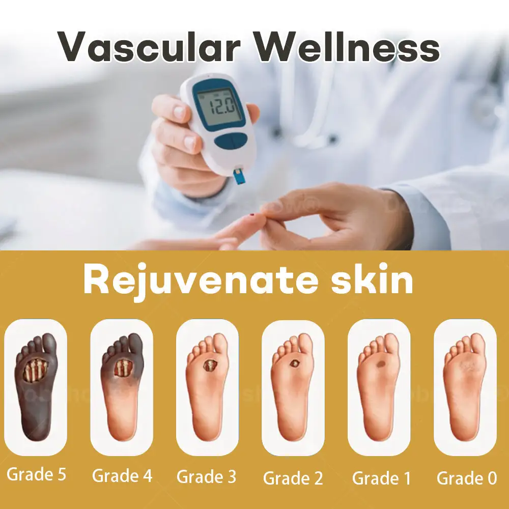 GlucoShield Bee Venom haavasuihke - Image 2