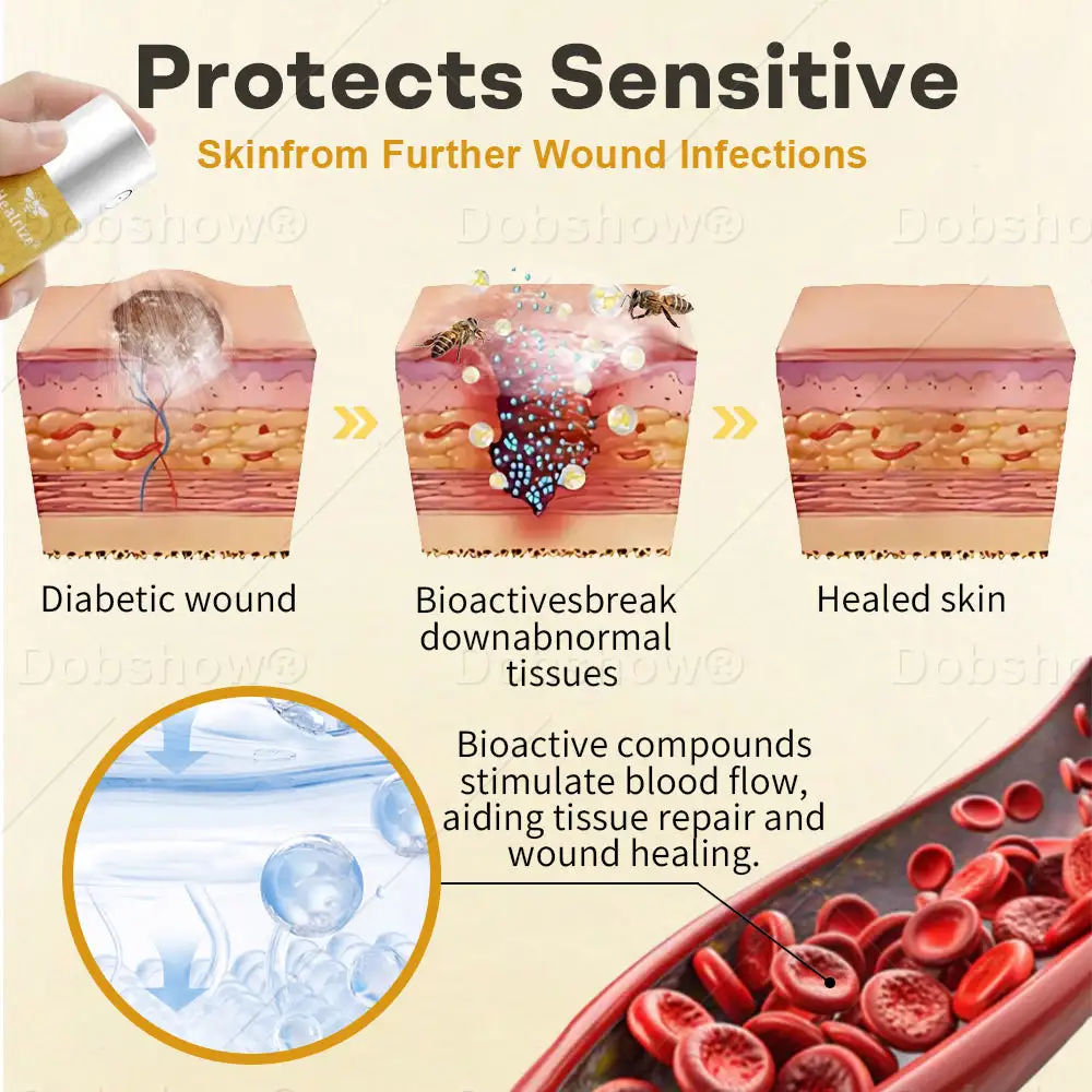 GlucoShield Bee Venom haavasuihke - Image 3