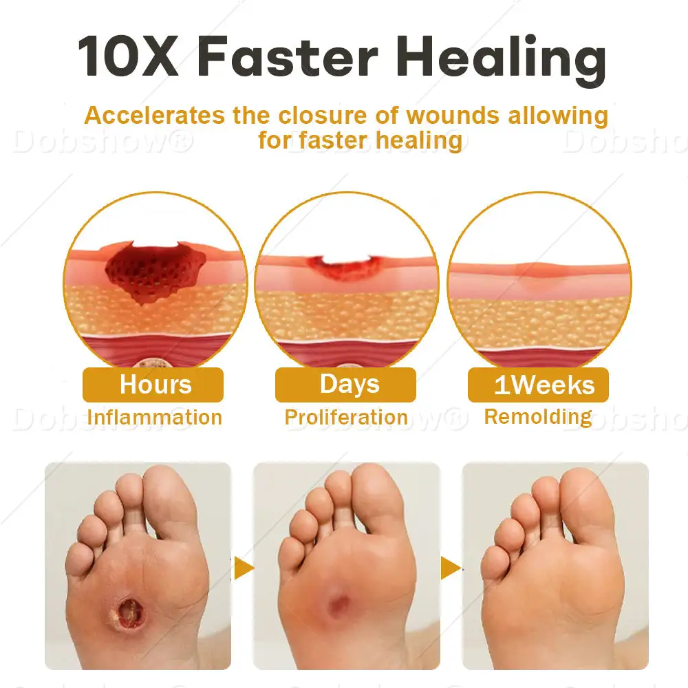 GlucoShield Bee Venom haavasuihke - Image 4