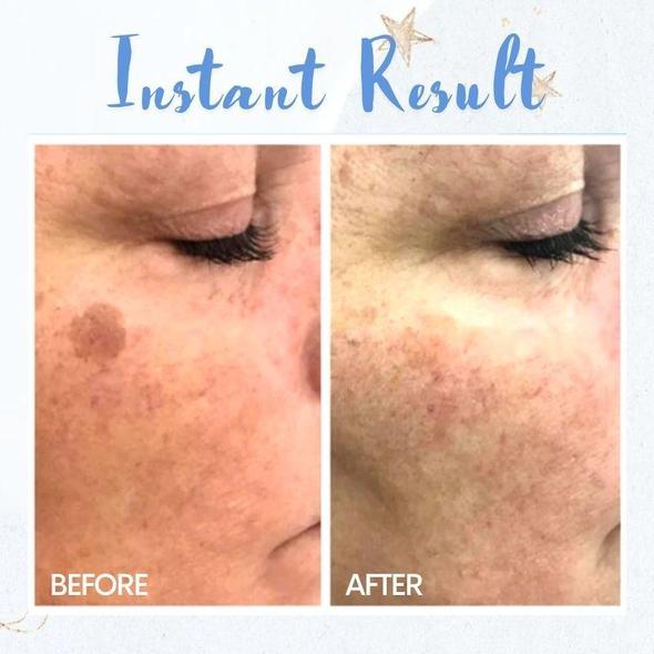 Tahranpoistokynä - Image 3