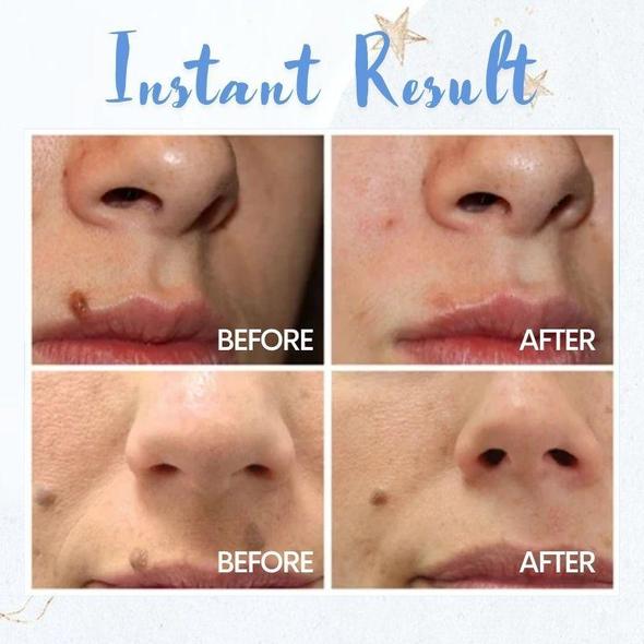 Tahranpoistokynä - Image 2