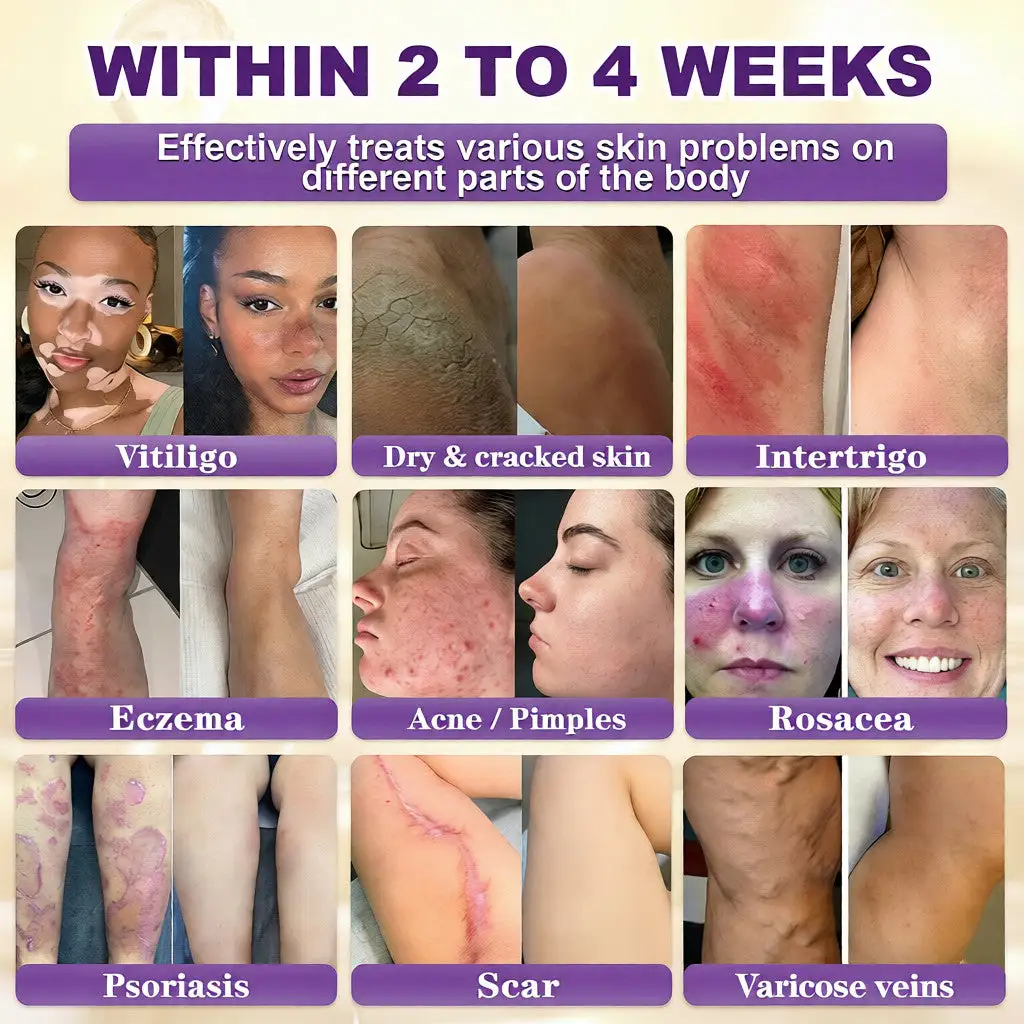 Biotiini 10-in-1 ihoa korjaava voide - Image 2