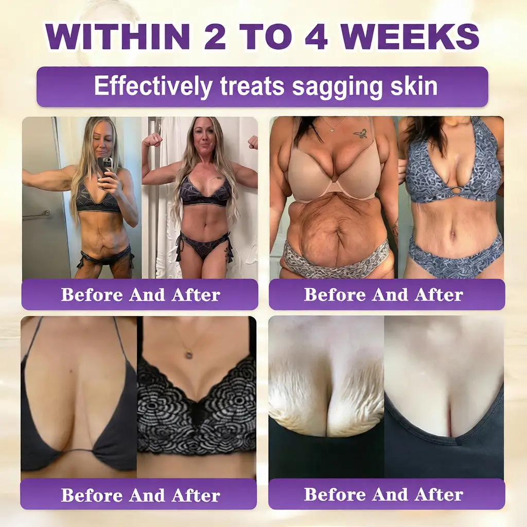 Biotiini 10-in-1 ihoa korjaava voide - Image 3