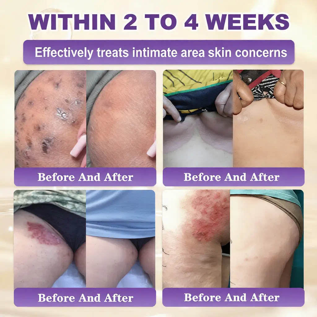 Biotiini 10-in-1 ihoa korjaava voide - Image 4