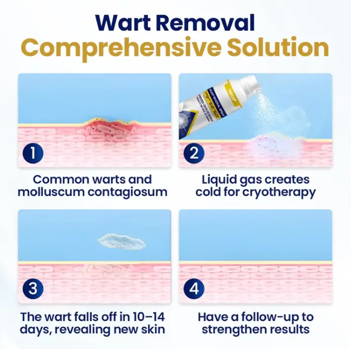 Chillique Bump Renewal Spray - Image 3